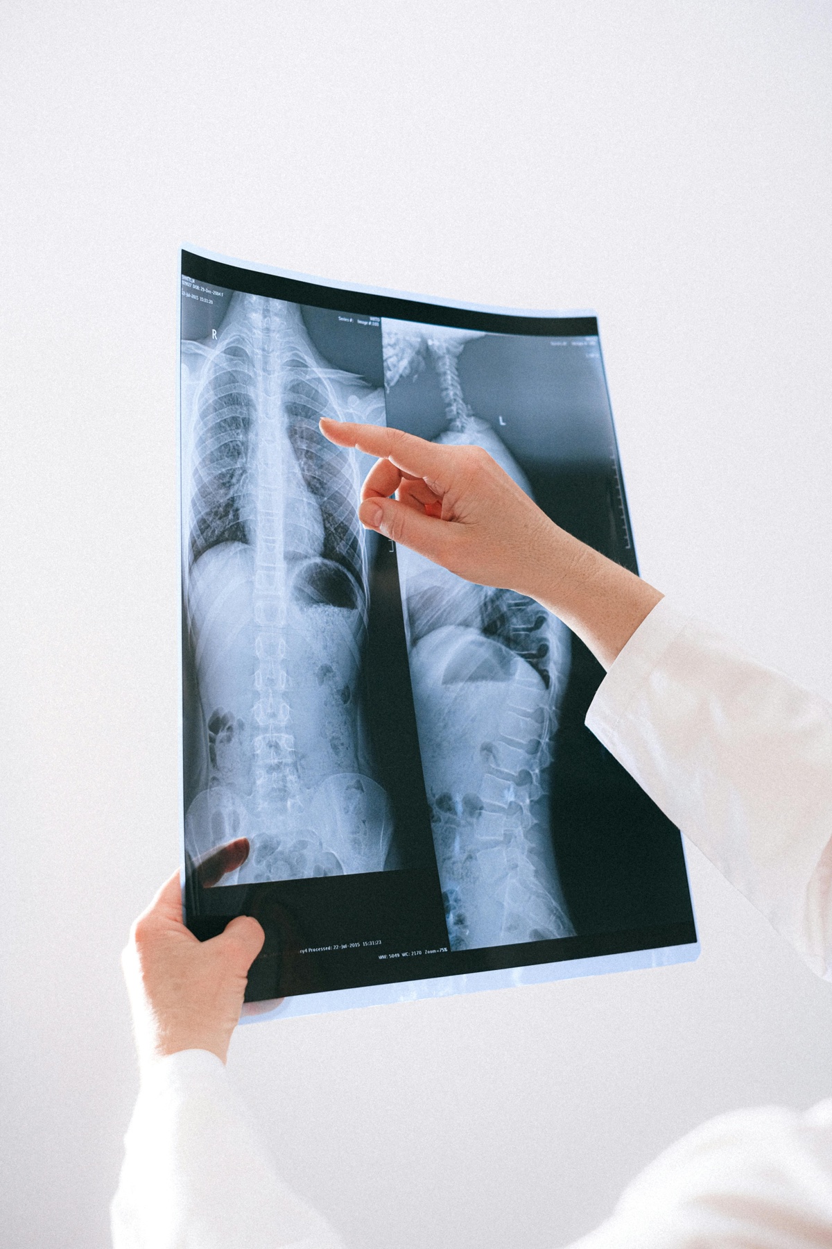 Alibaba's "Coca" AI Beats 10 Radiologists at Catching Early Colon Cancer